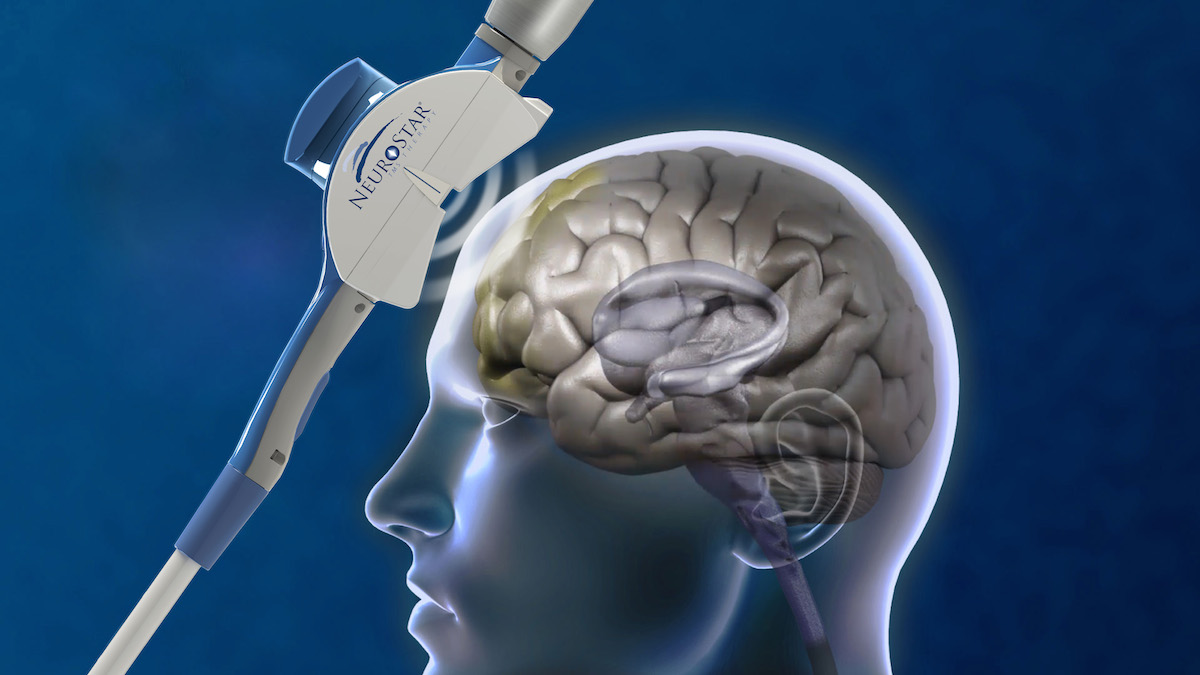 Depressed-Brain_being-treated_small